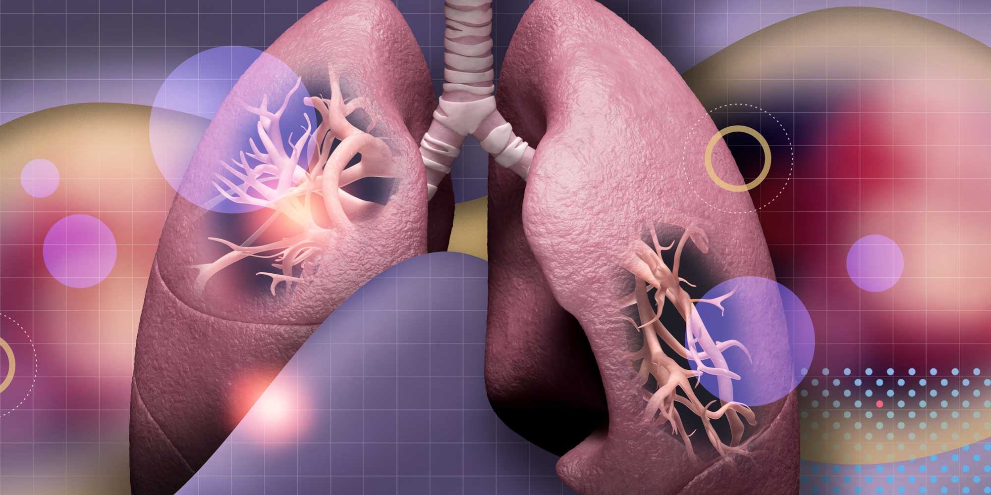 Immunotherapy Drug Is Well Tolerated in Lung Cancer Patients with Limited Physical Function