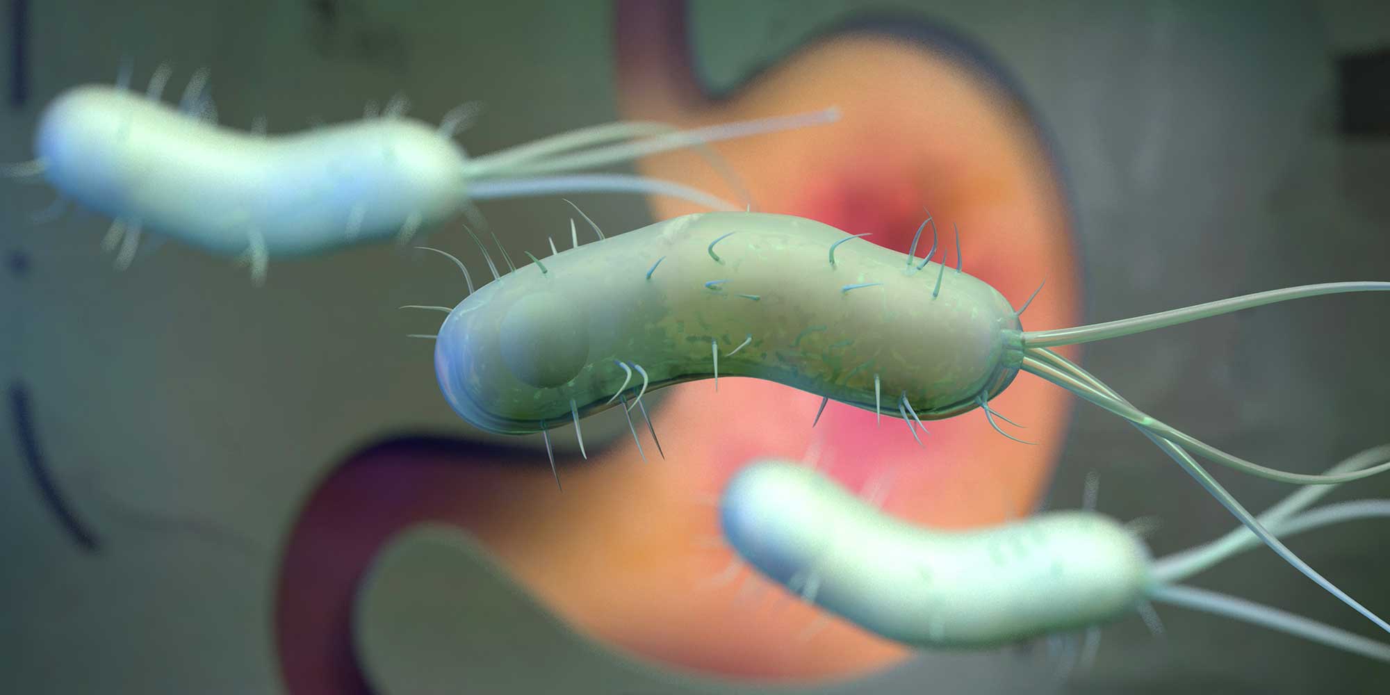 H. pylori: who to test and how to treat
