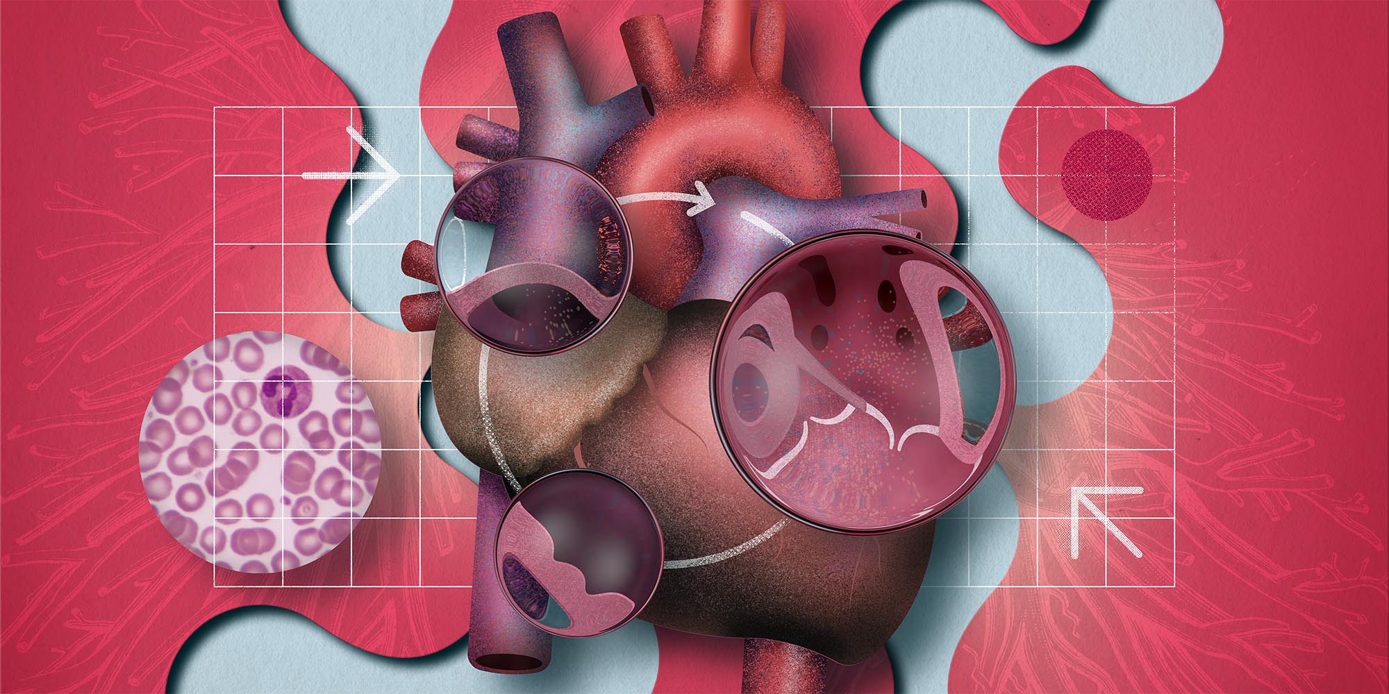 Addressing heart failure in primary care
