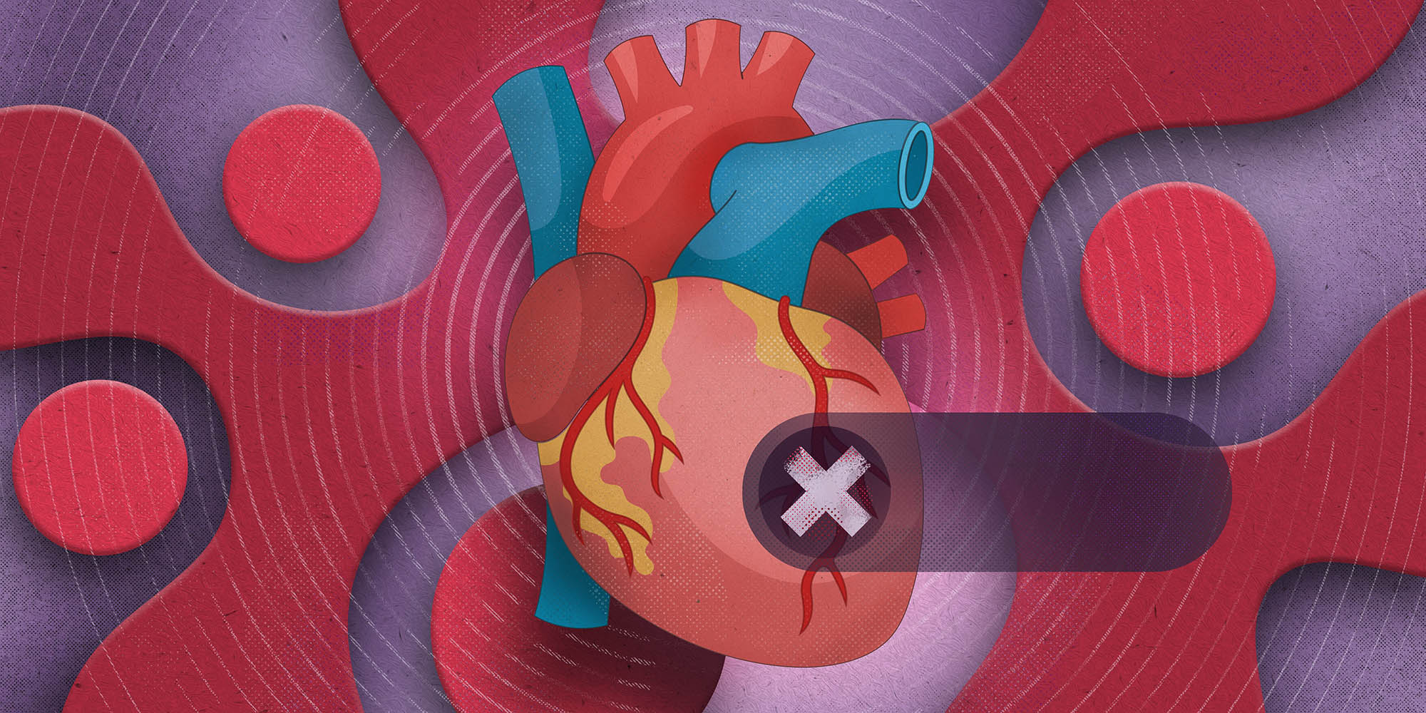 Addressing heart failure in primary care