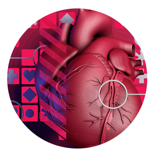 acute coronary syndrome ACS