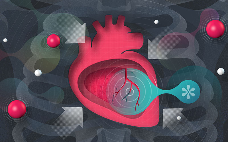 Management of stable angina pectoris