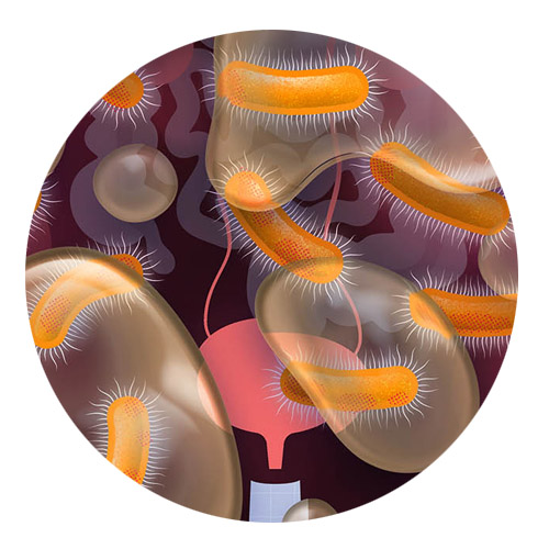 Clinical Audit: Uncomplicated UTIs