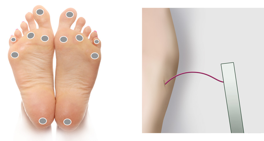 Diabetic Peripheral Neuropathy - Highlands Foot and Ankle