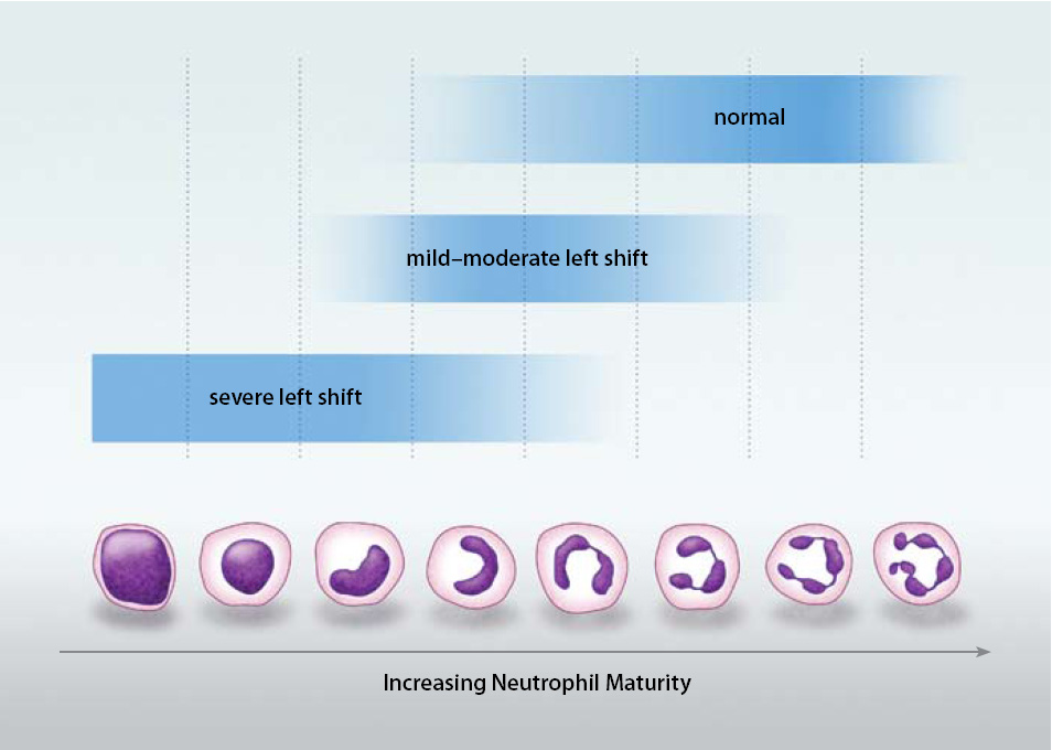 abnormal white blood cell levels